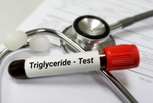 Você sabe o que são os triglicerídeos?