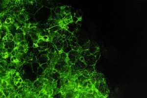 6 doenças relacionadas ao excesso de toxinas no corpo