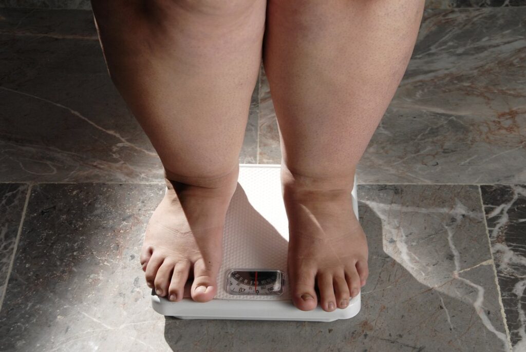 Saiba quais são os graus da obesidade e os tratamentos indicados