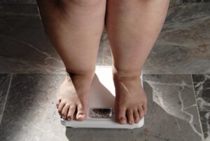Saiba quais são os graus da obesidade e os tratamentos indicados