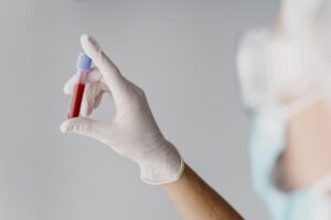 4 exames indicados para diagnóstico de diabetes