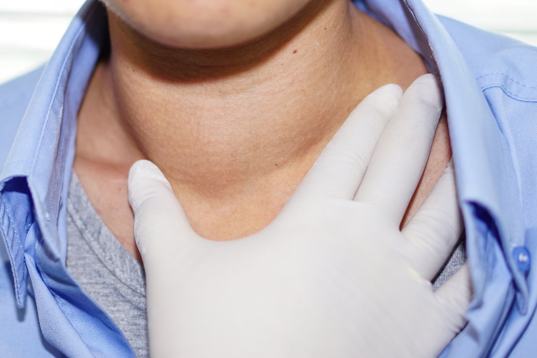 Quando se preocupar com o nódulo na tireoide?